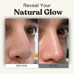 Blackhead Pull Cream